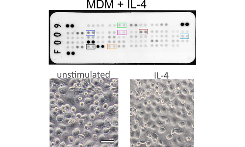 Proteome ProfilerTM from R&D systems allows evaluation of angiogenic factors in IL-4 polarized human monocyte-derived macrophage conditioned medium. 